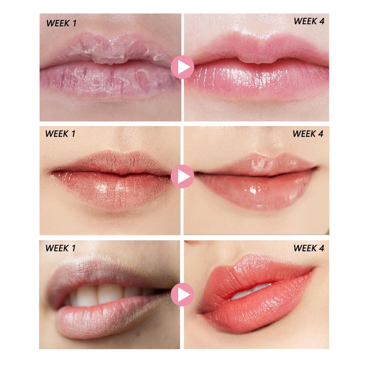 Dior - Dior Addict Lip Sugar Scrub | 3.4 g