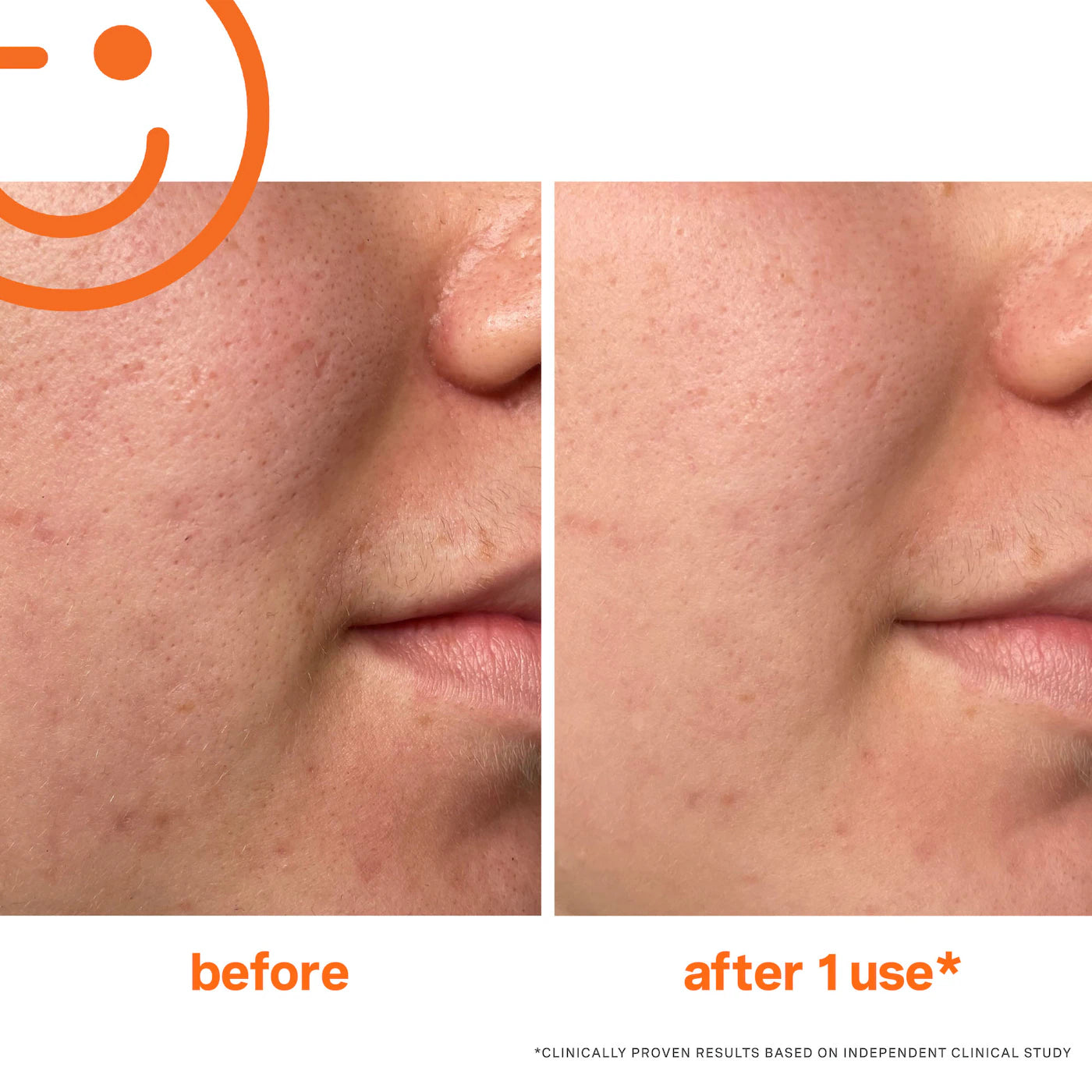 Kate Somerville - ExfoliKate™ Intensive Exfoliating Treatment | 60 mL