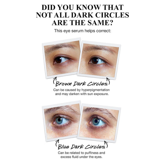 Kiehl's - Powerful-Strength Dark Circle Reducing Vitamin C Eye Serum | 15 mL