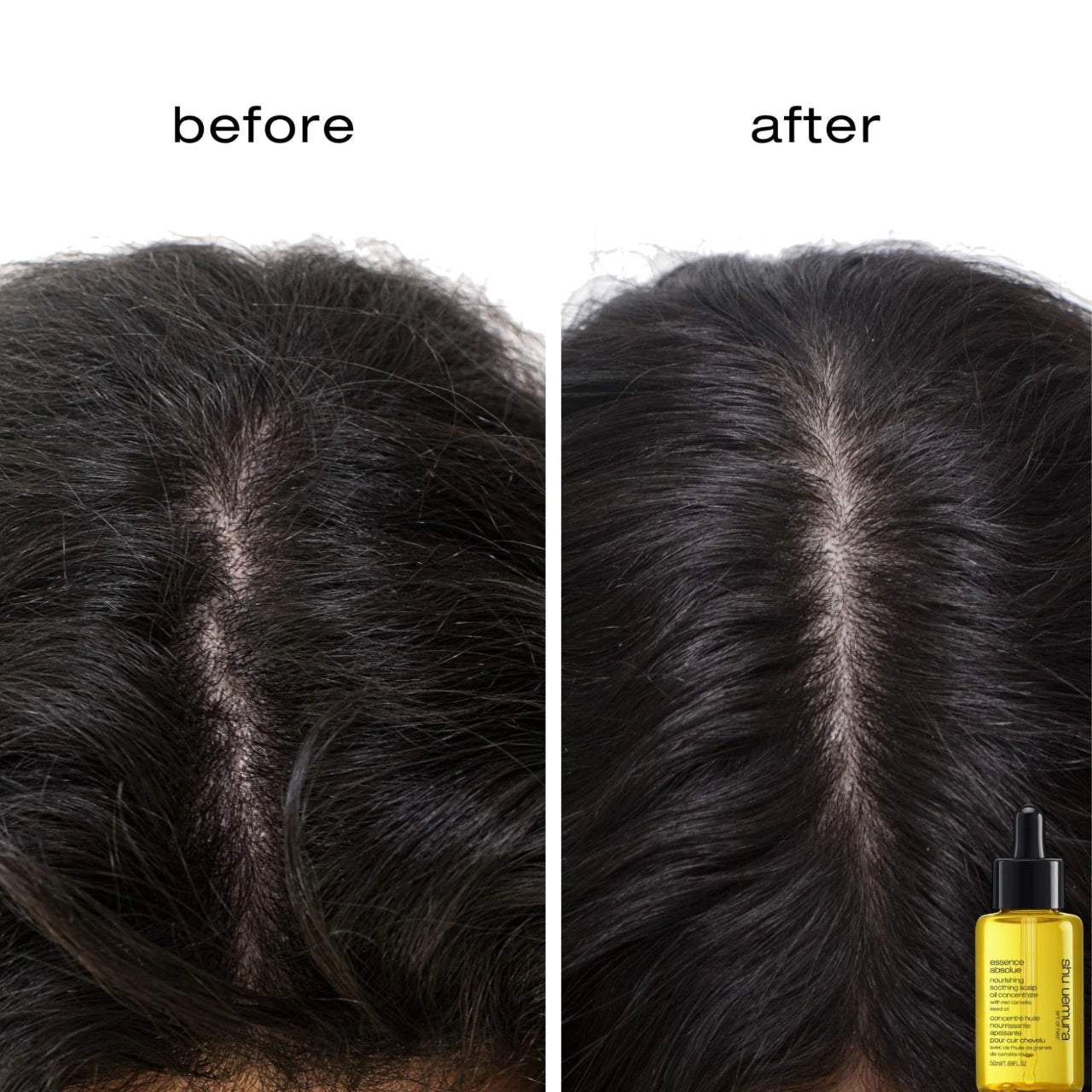 shu uemura - Essence Absolue Pre-Shampoo & Nourishing Treatment Oil for Scalp & Hair | 50 mL