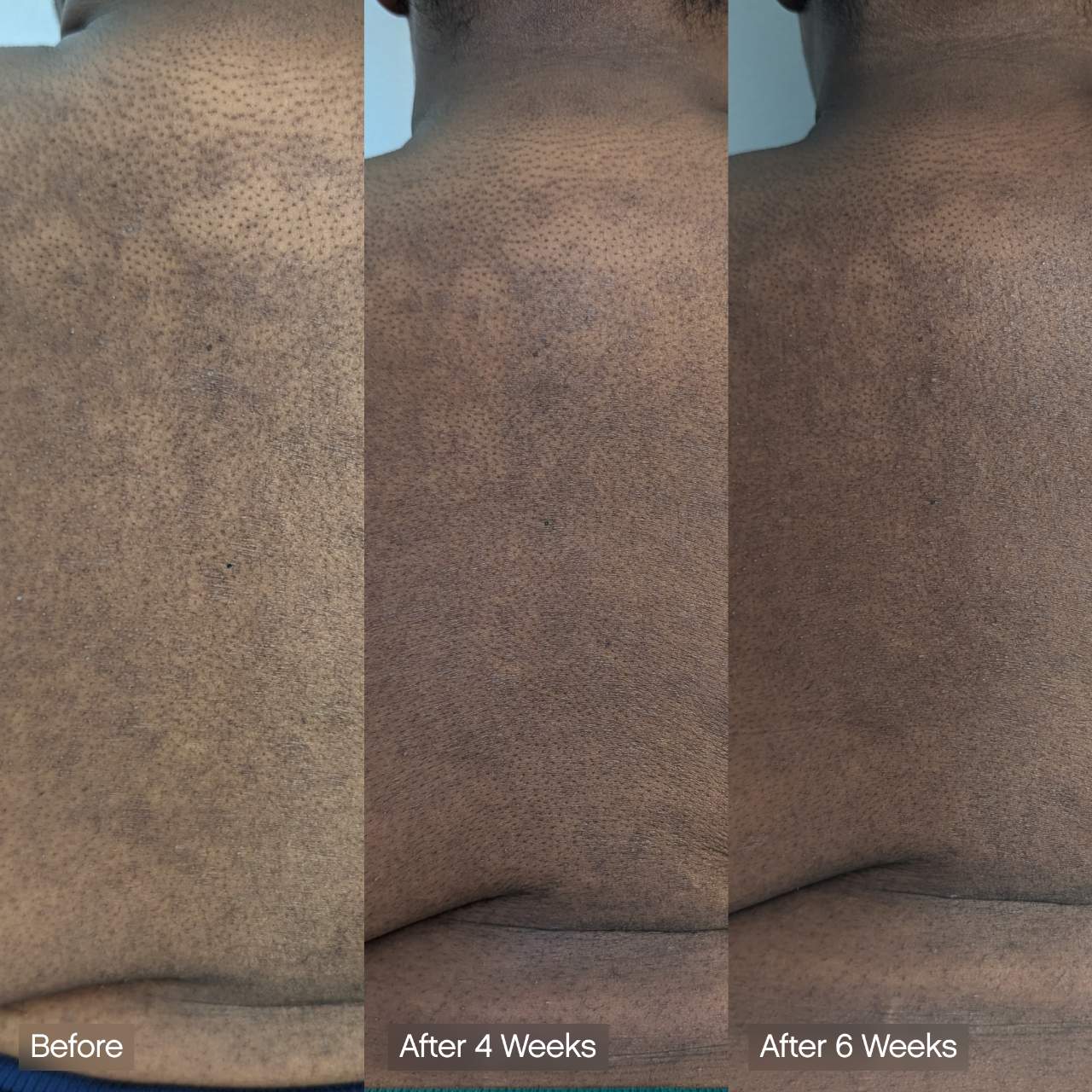 Topicals - Faded Brightening & Cleansing Body Bar for Uneven Skin Tone