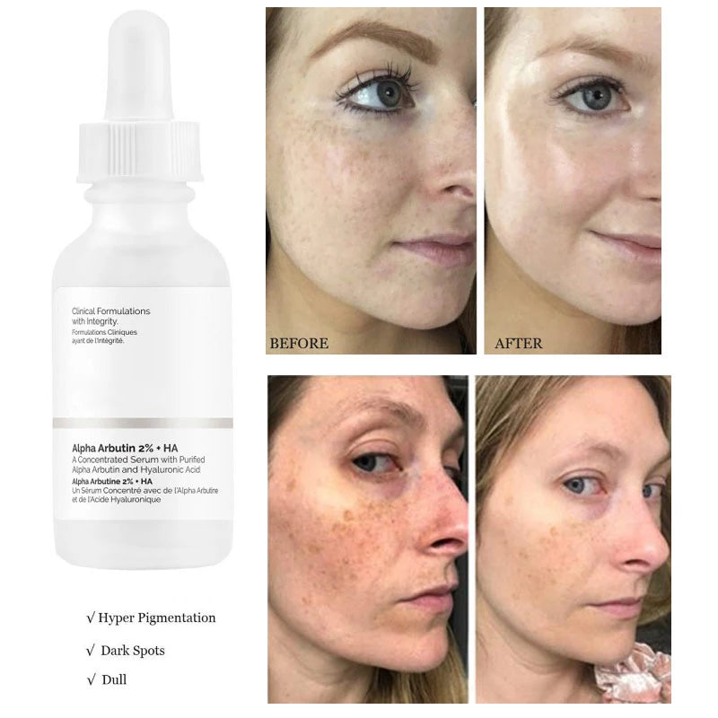 The Ordinary - Alpha Arbutin 2% + HA Hyperpigmentation Serum