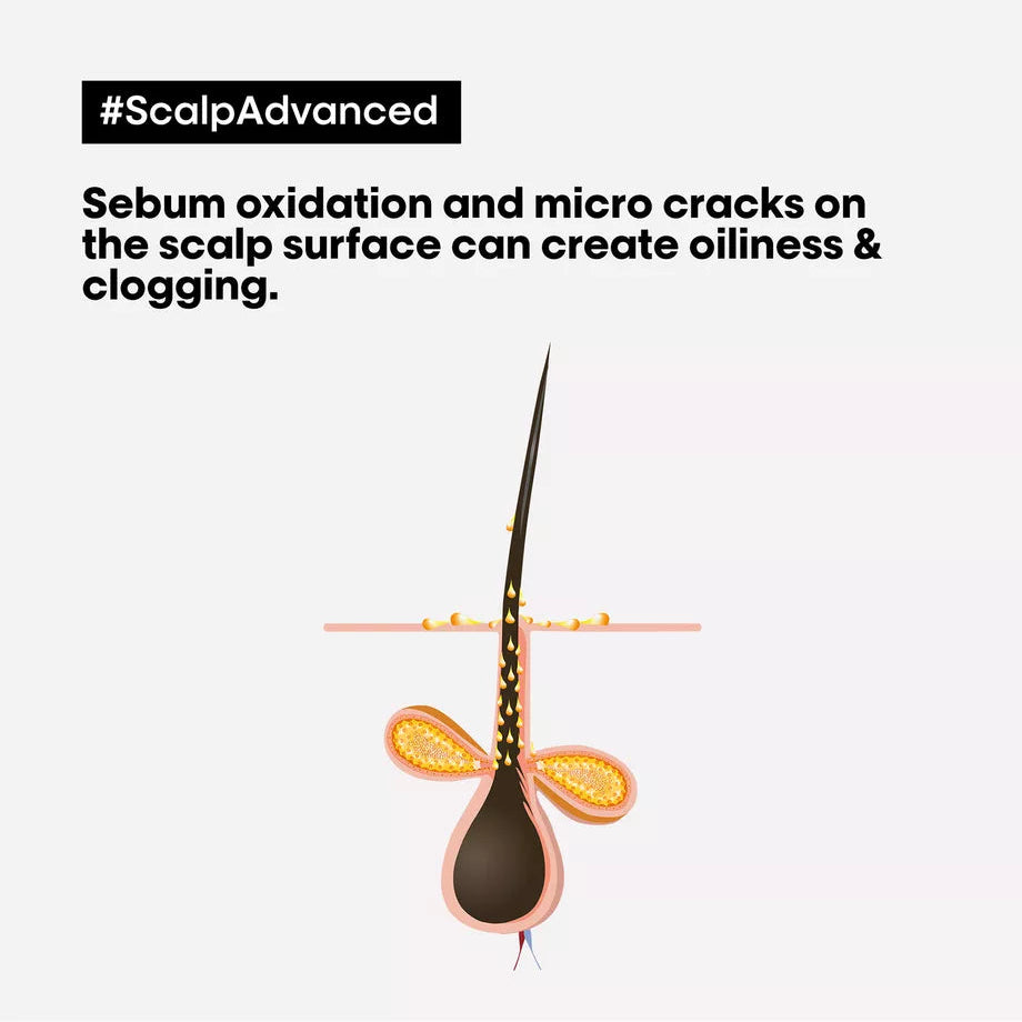 L'Oréal Professionnel Paris - Scalp Advanced Anti-Oiliness Shampoo| 300 mL