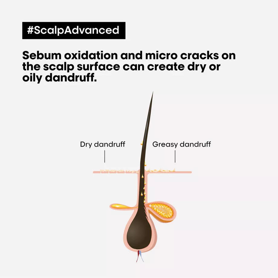 L'Oréal Professionnel Paris - Scalp Advanced Anti-Dandruff Shampoo| 300 mL