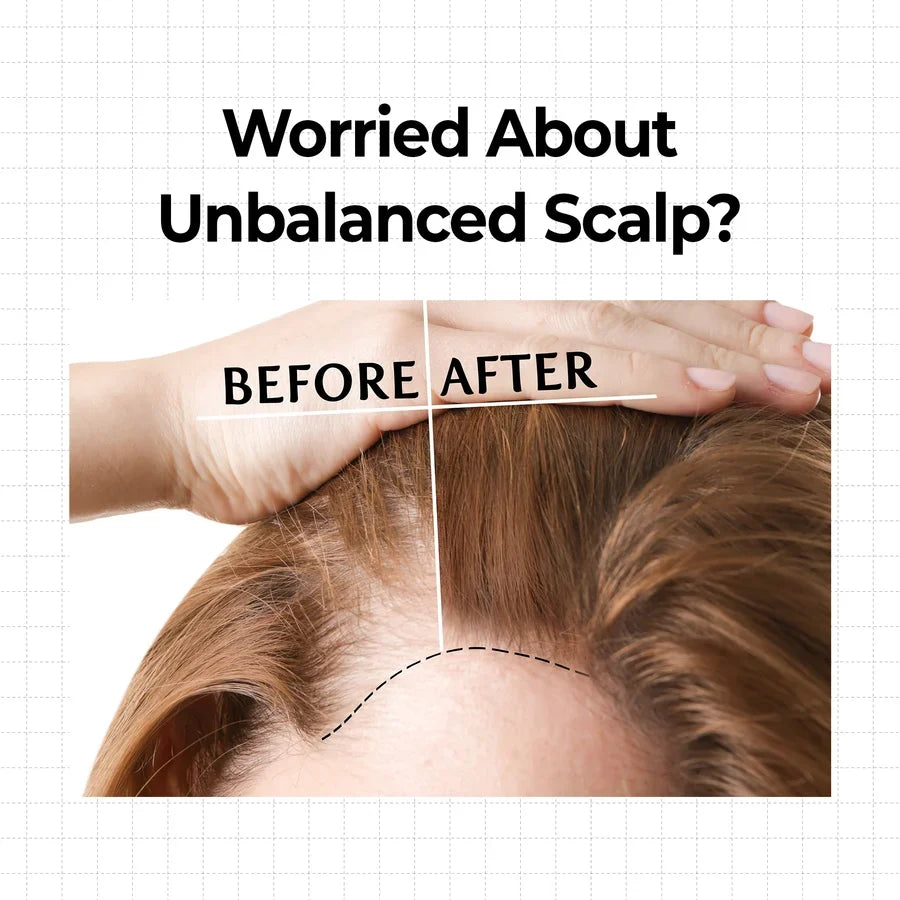 KUNDAL - 10x Caffeine Strengthening Scalp Serum | 10mL