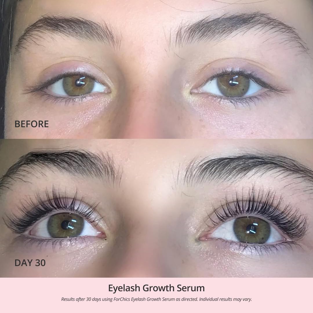 FORCHICS - EYELASH ENHANCING SERUM | 3ML