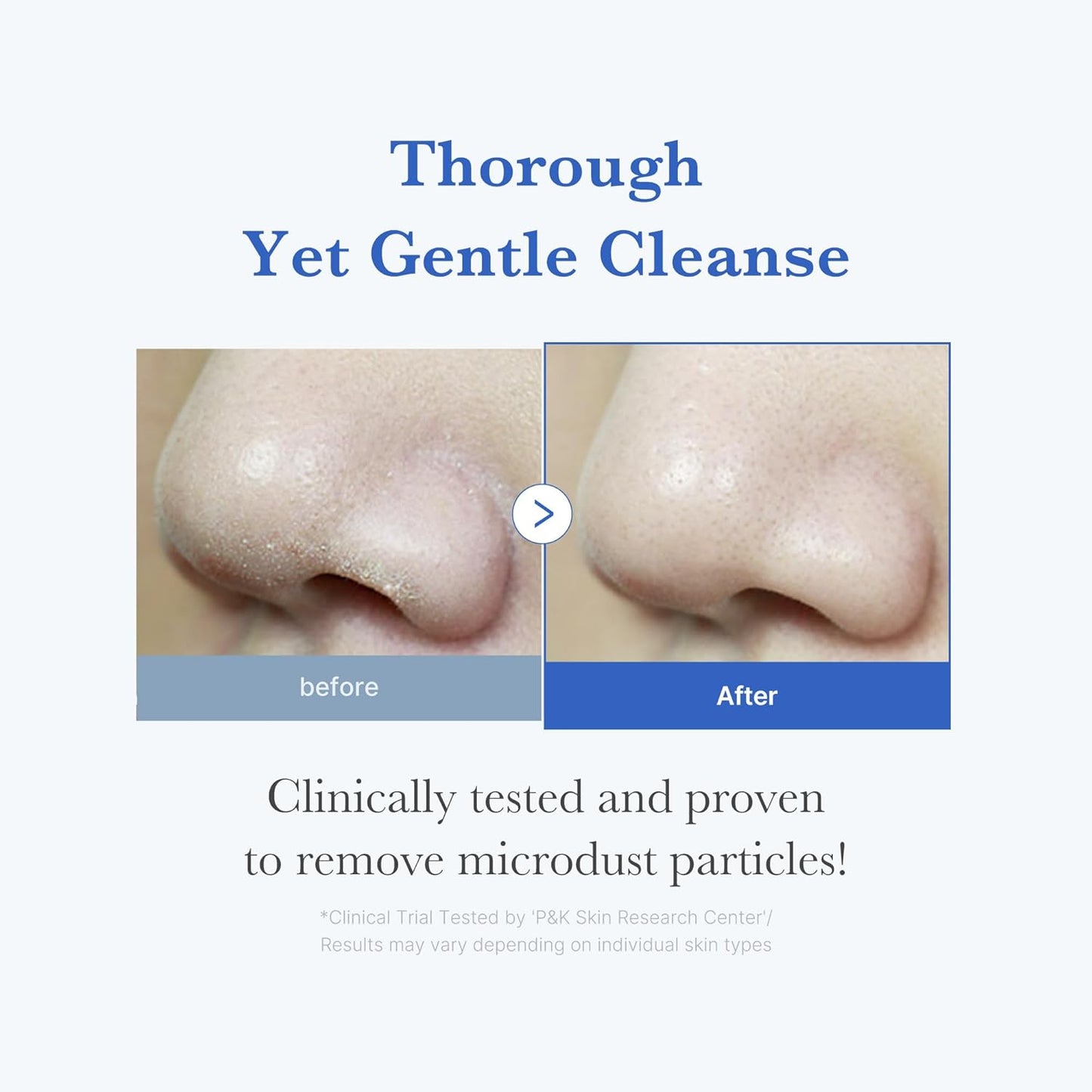 MEDICUBE - Zero Foam Cleanser | 120 ML