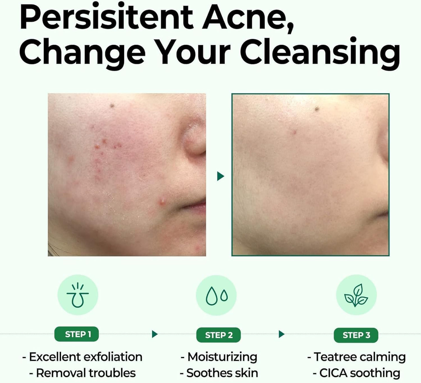 SOME BY MI - AHA BHA PHA 30 Days Miracle Cleansing Bar