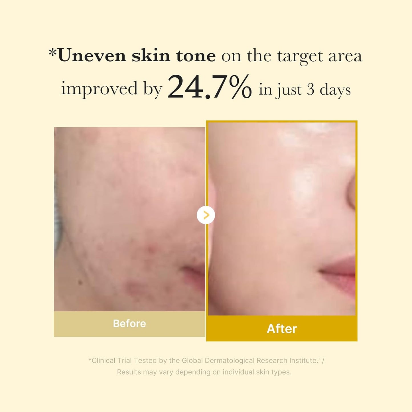 MEDICUBE - Kojic Acid Turmeric Night Wrapping Mask | 75 ML