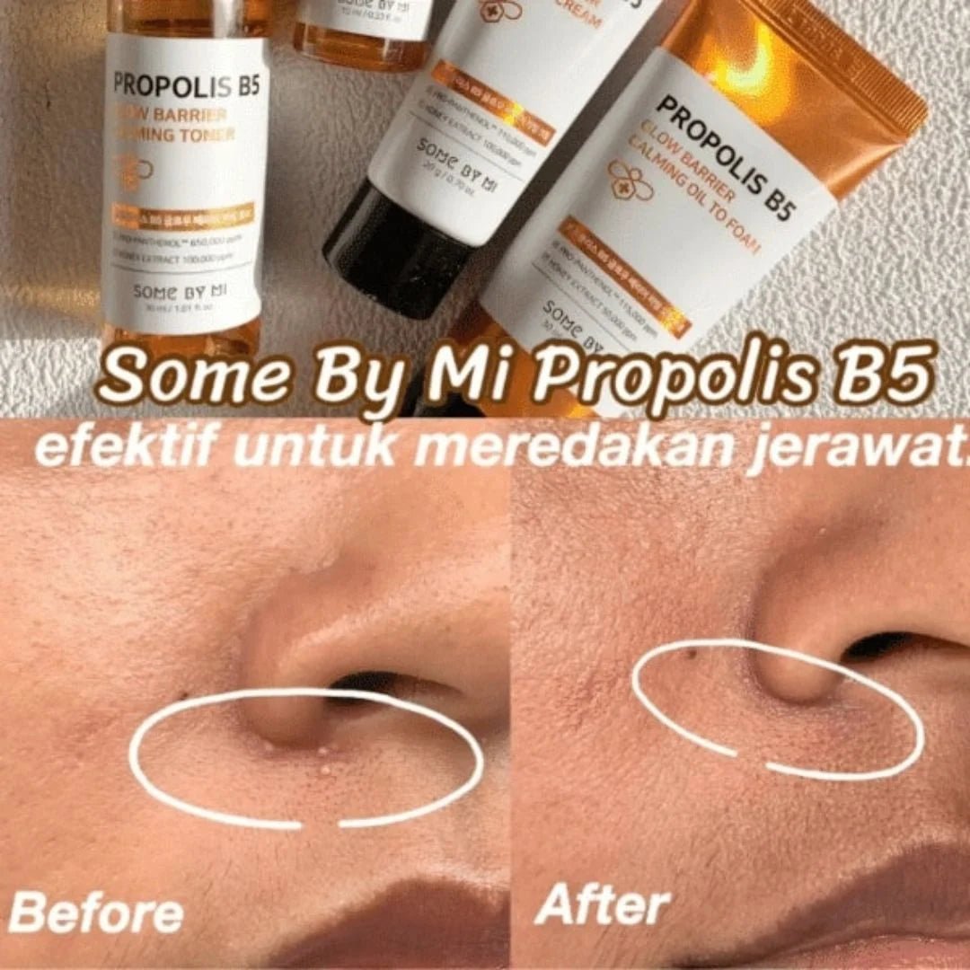 SOME BY MI - Propolis B5 Glow Barrier Calming Starter Kit