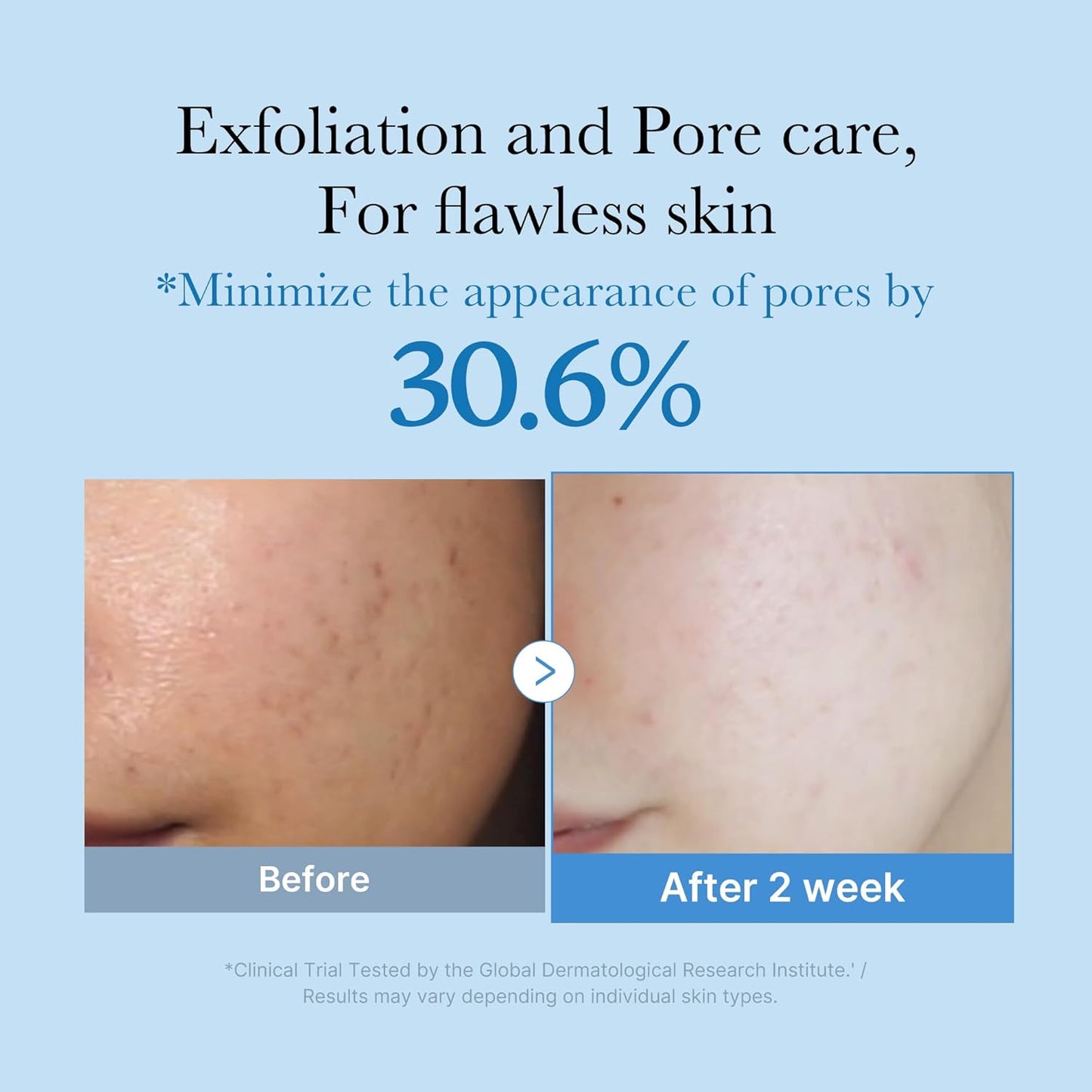 MEDICUBE - Zero Pore Toner 250 ML
