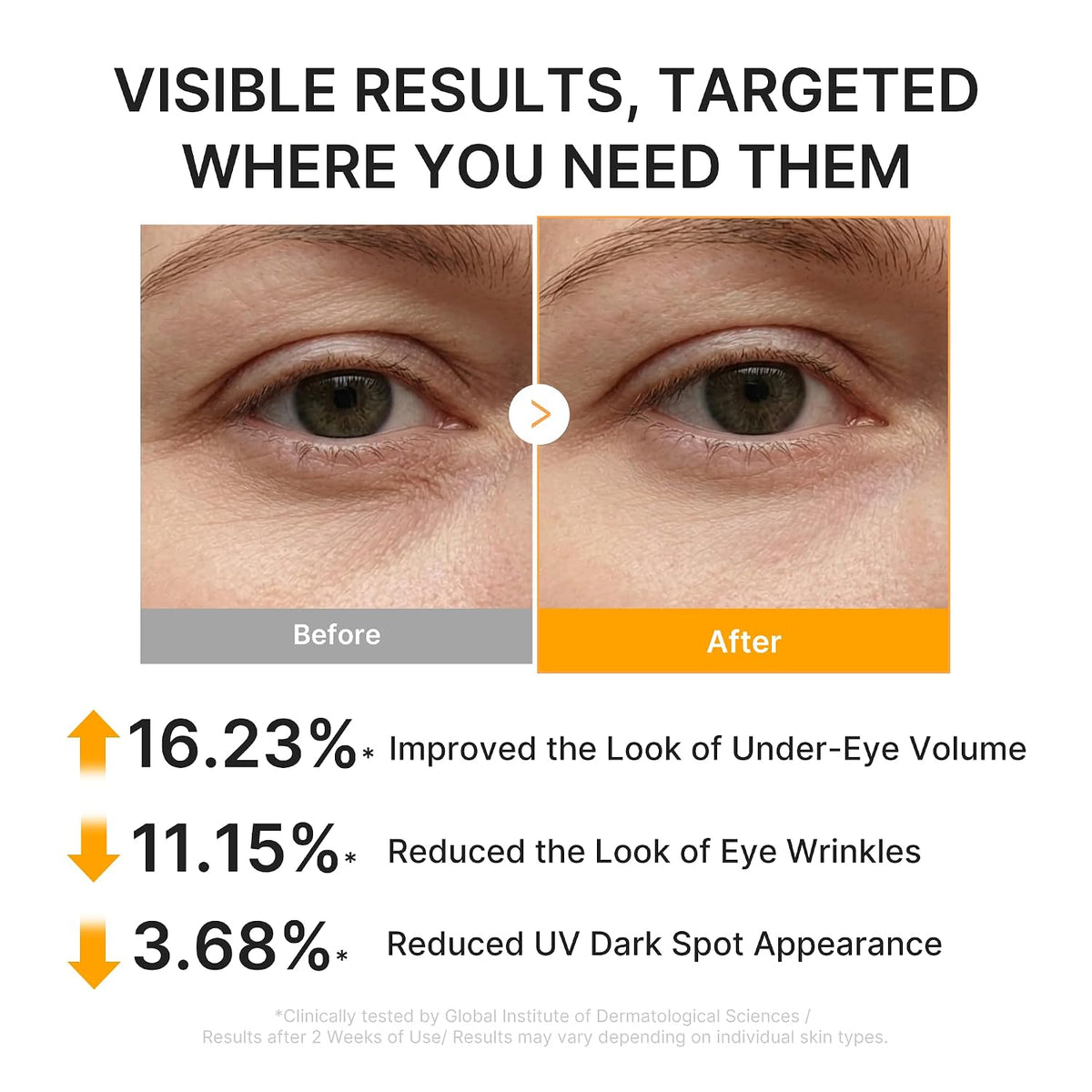 MEDICUBE - Kojic acid turmeric eye patches - 60 pcs