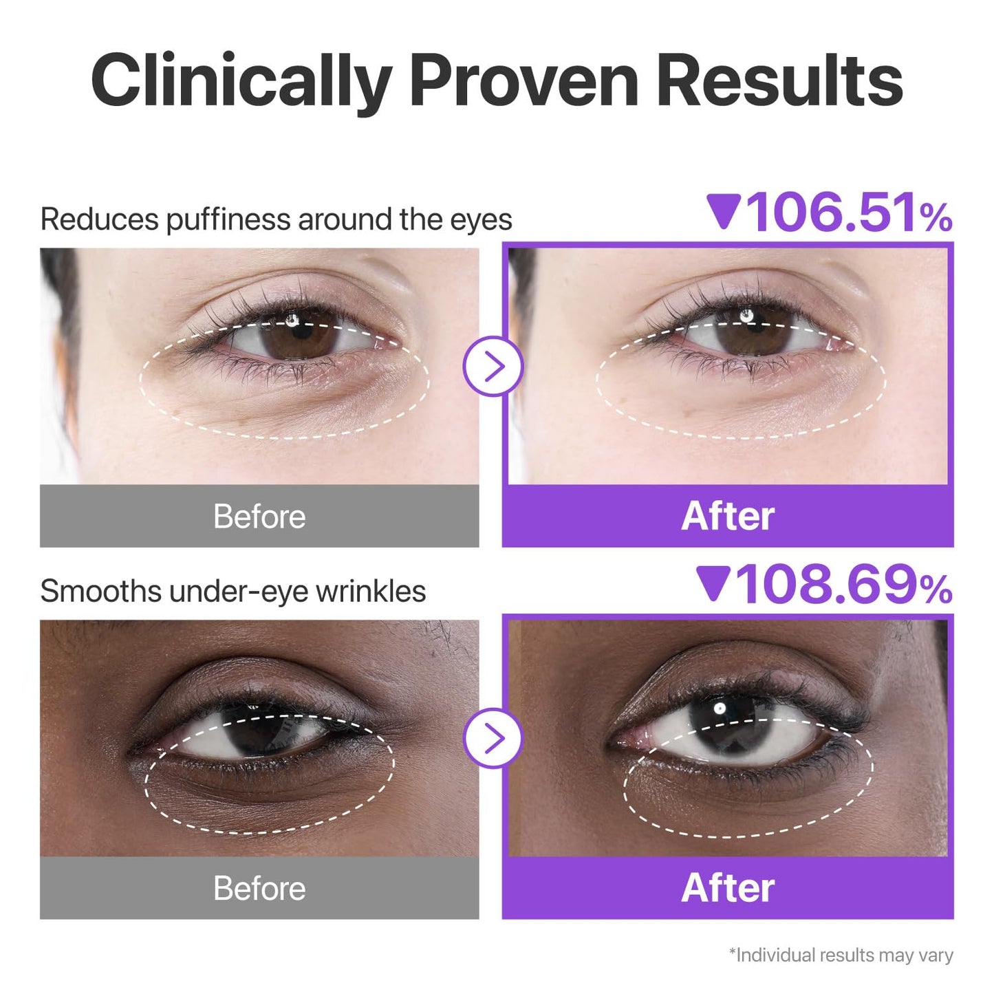 NUMBUZIN - No.9 Eye Patches, NAD+ Collagen | 5 Pairs