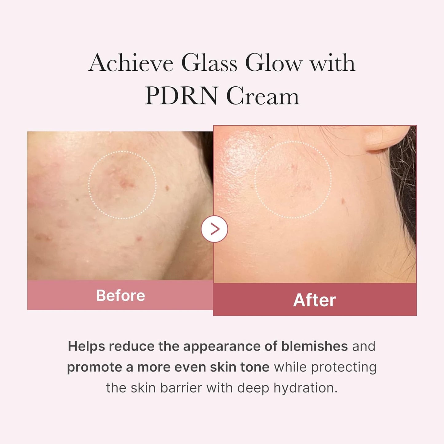 MEDICUBE - PDRN Pink Hyaluronic Moisturizing Cream | 50 ML