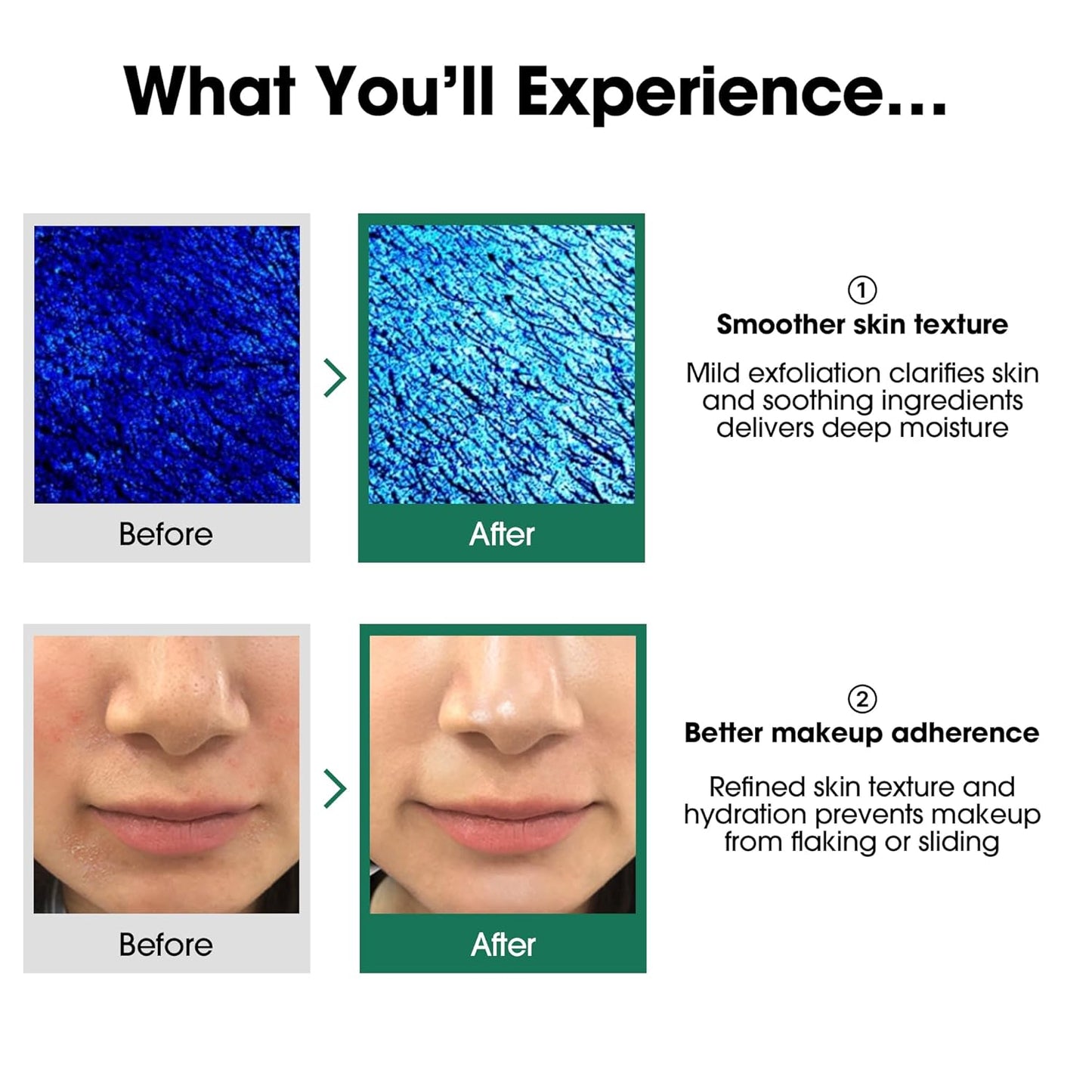 SOME BY MI - AHA BHA PHA 30 Days Miracle Toner | 150 ML