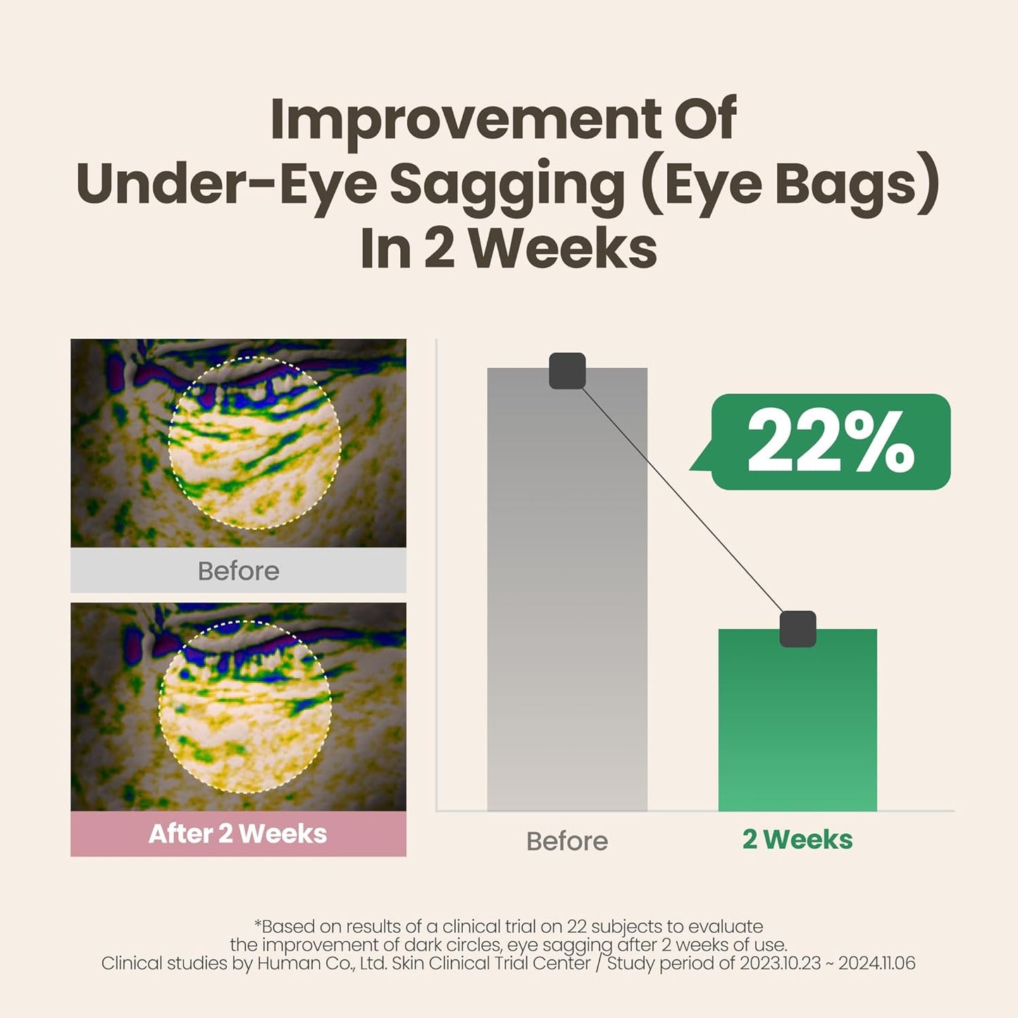 AXIS-Y- Lip & Eye Set