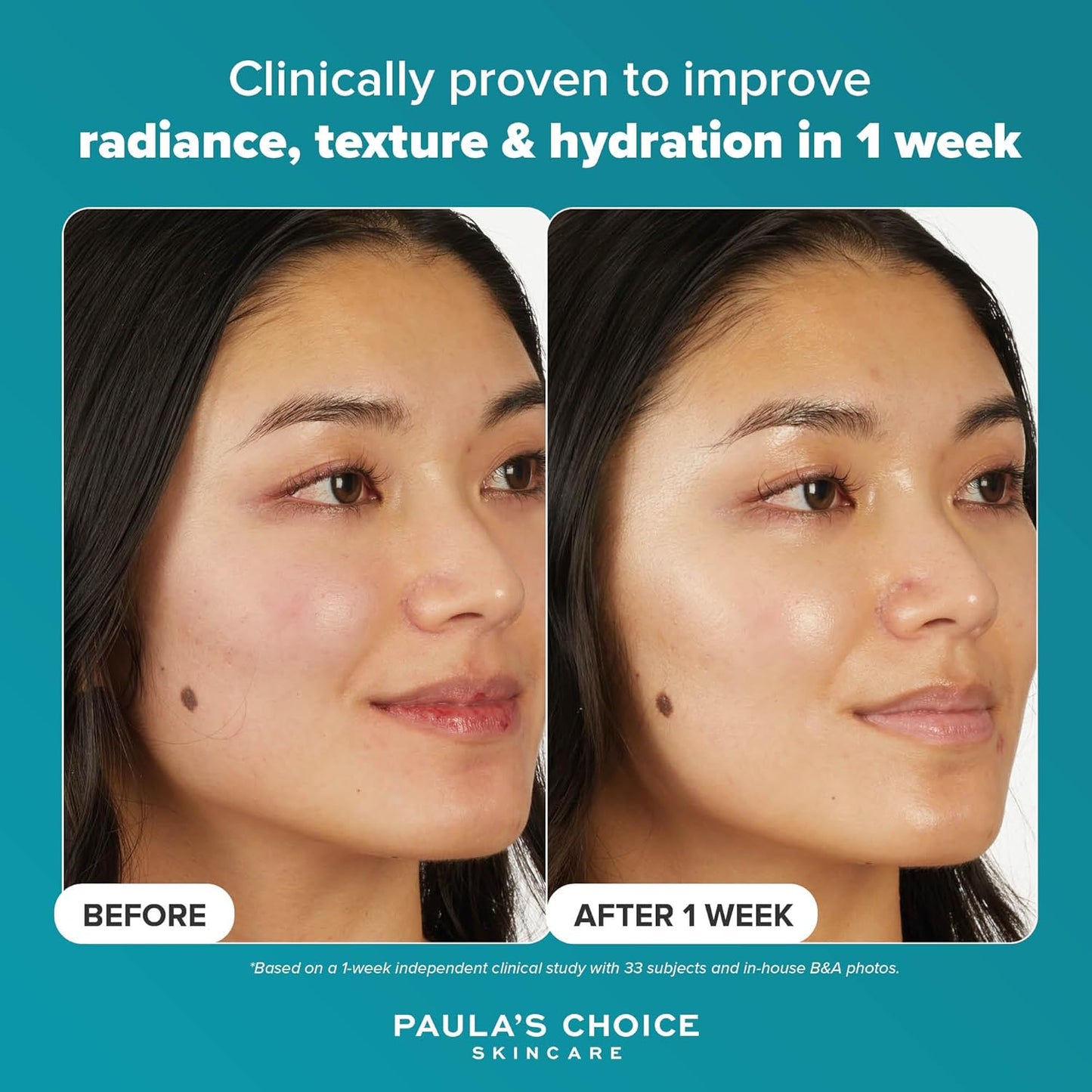Paula's Choice - 7% Ectoin + Hyaluronic Acid Milky Hydrating Face Serum | 20 mL