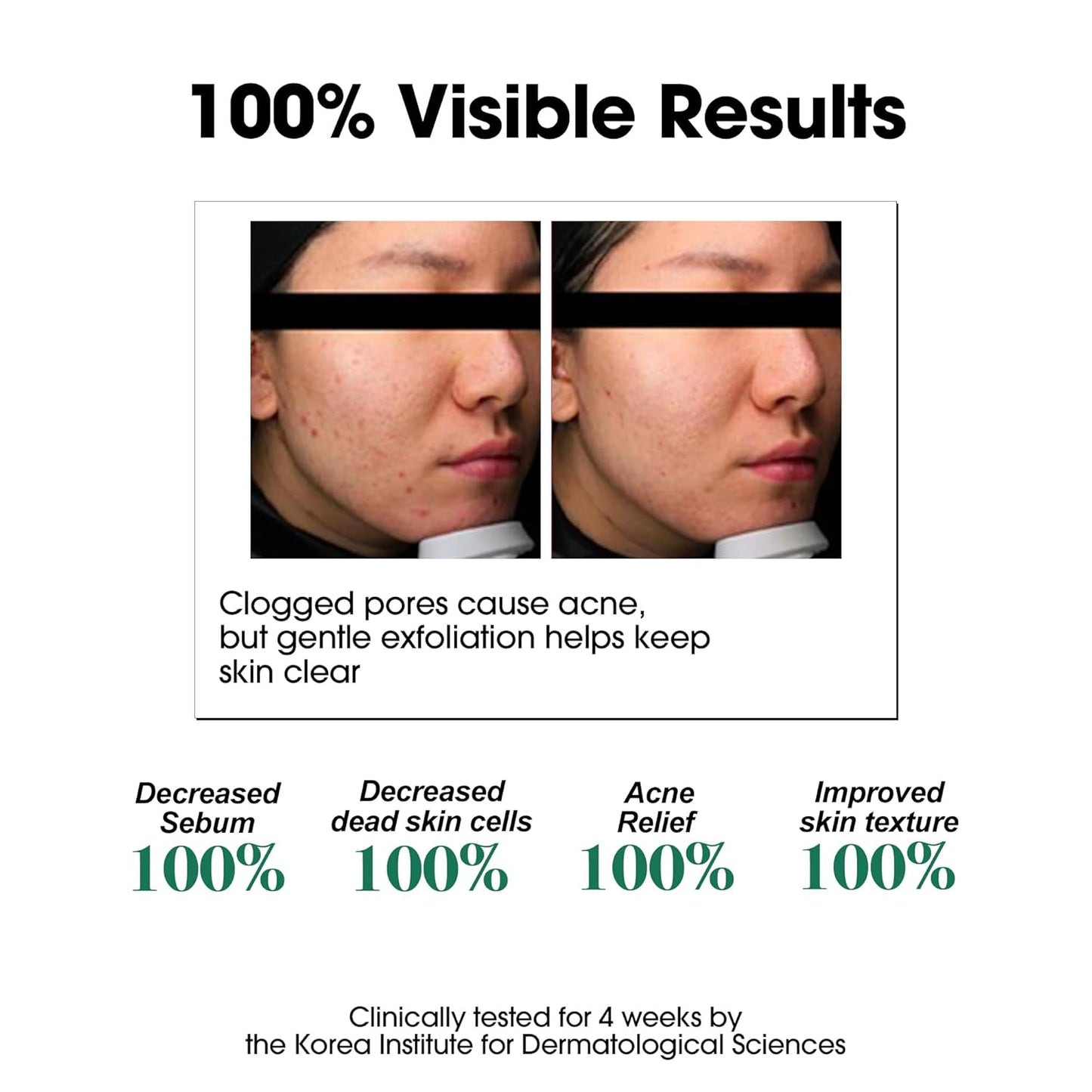 SOME BY MI - AHA BHA PHA 30 Days Miracle Toner | 150 ML