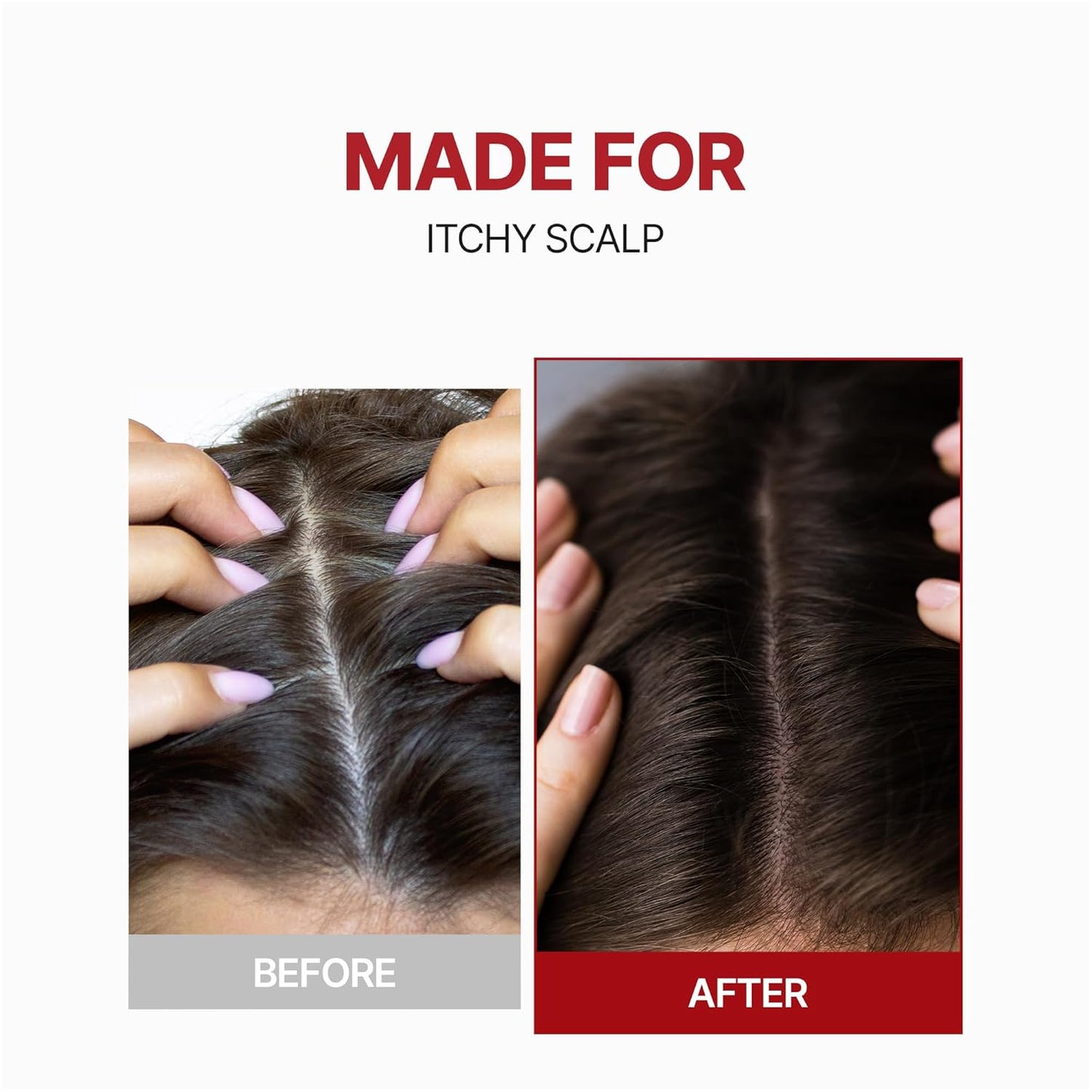 Kundal - Caffeine Hair Loss Scalp Tonic | 100 mL