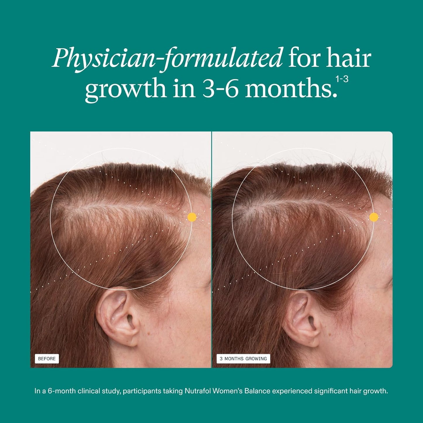 NUTRAFOL WOMEN's BALANCE - HAIR GROWTH NUTRACEUTICAL | 120 CAPSULES