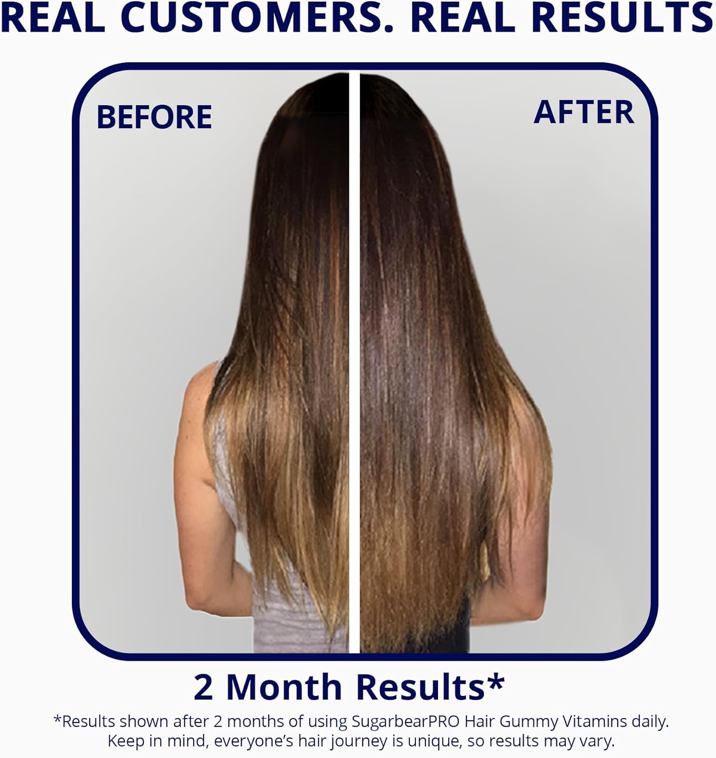 Sugarbear Pro Hair Vitamin Vegan Gummies - 1 Month