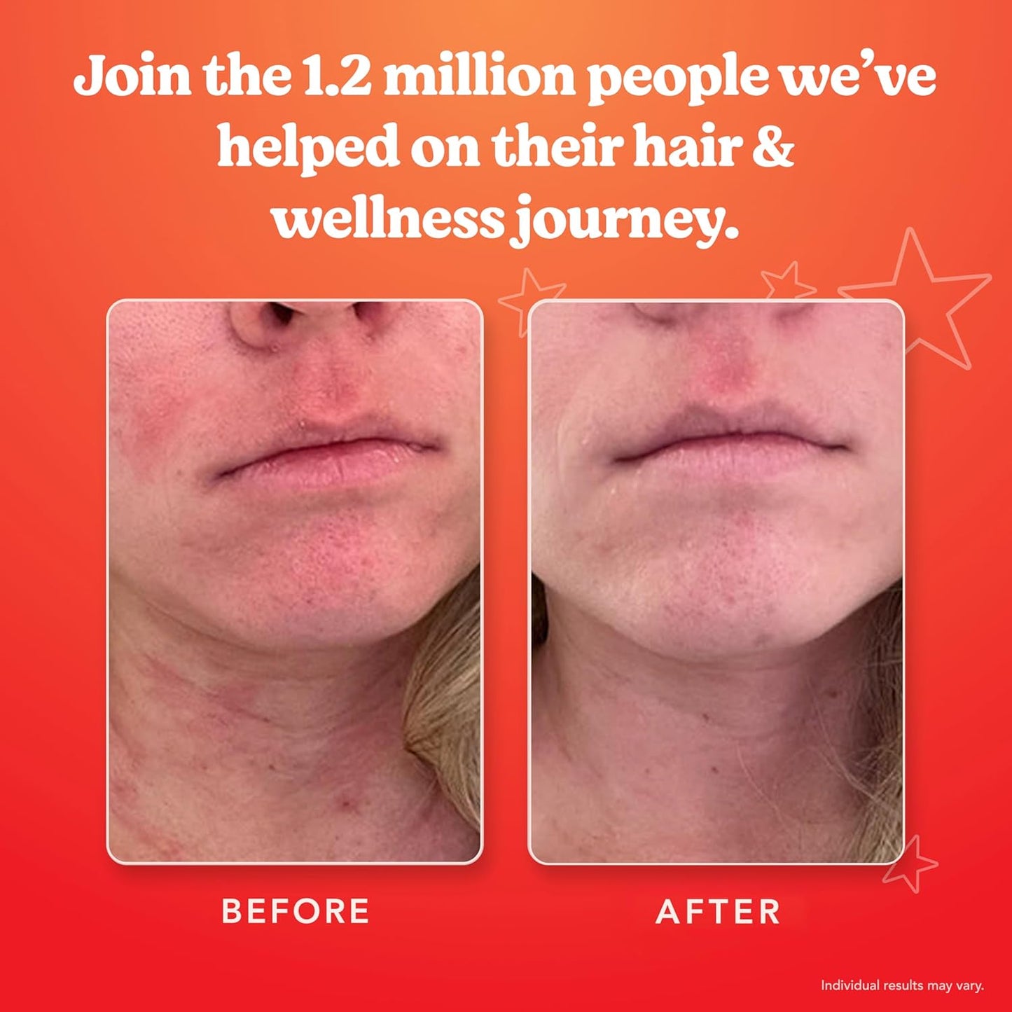 SKINtamin - Vegetarian Collagen Pills | 30 Capsules