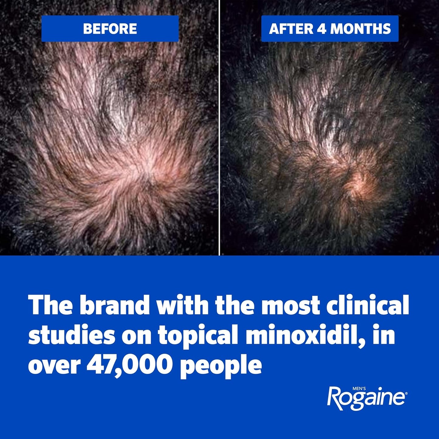 Men's Rogaine Minoxidil 5% Foam 3x 2.11 oz Bottles