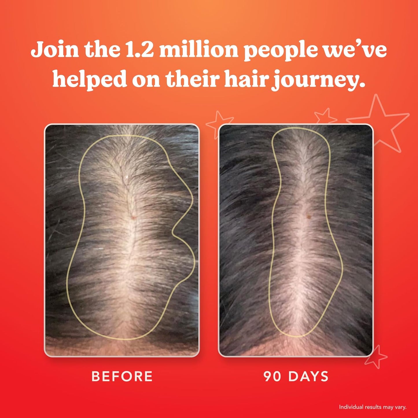 HAIRtamin - Advanced Formula Hair Vitamins | 30 Capsules