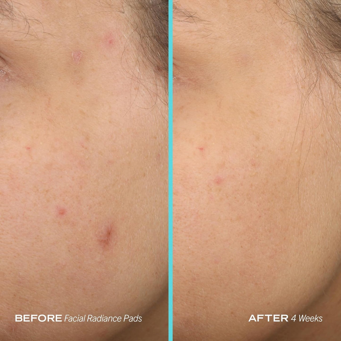 First Aid Beauty - Sensitive Skin Starter Kit