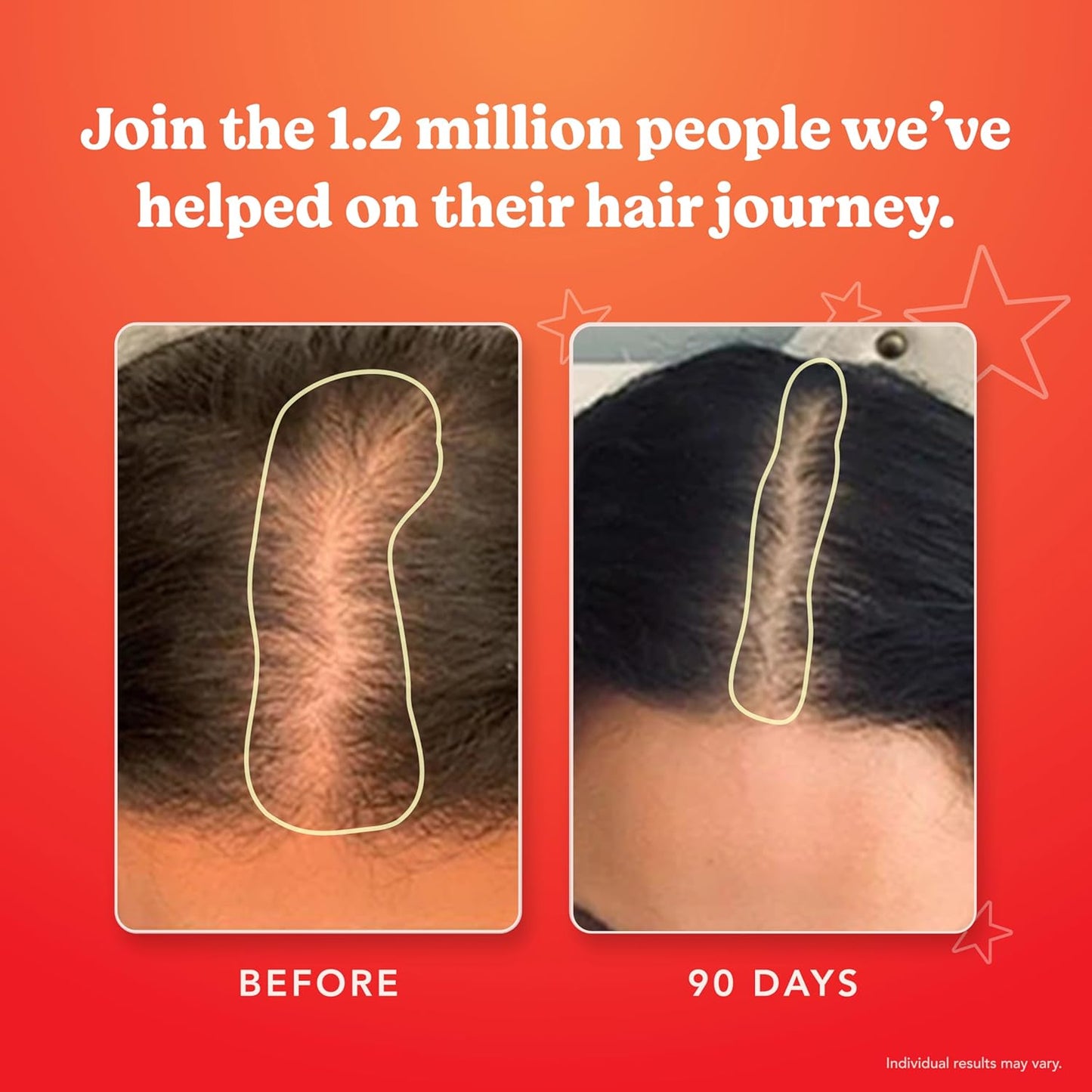 HAIRtamin - Vegan Gummy Stars Hair Vitamins | 60 Gummies