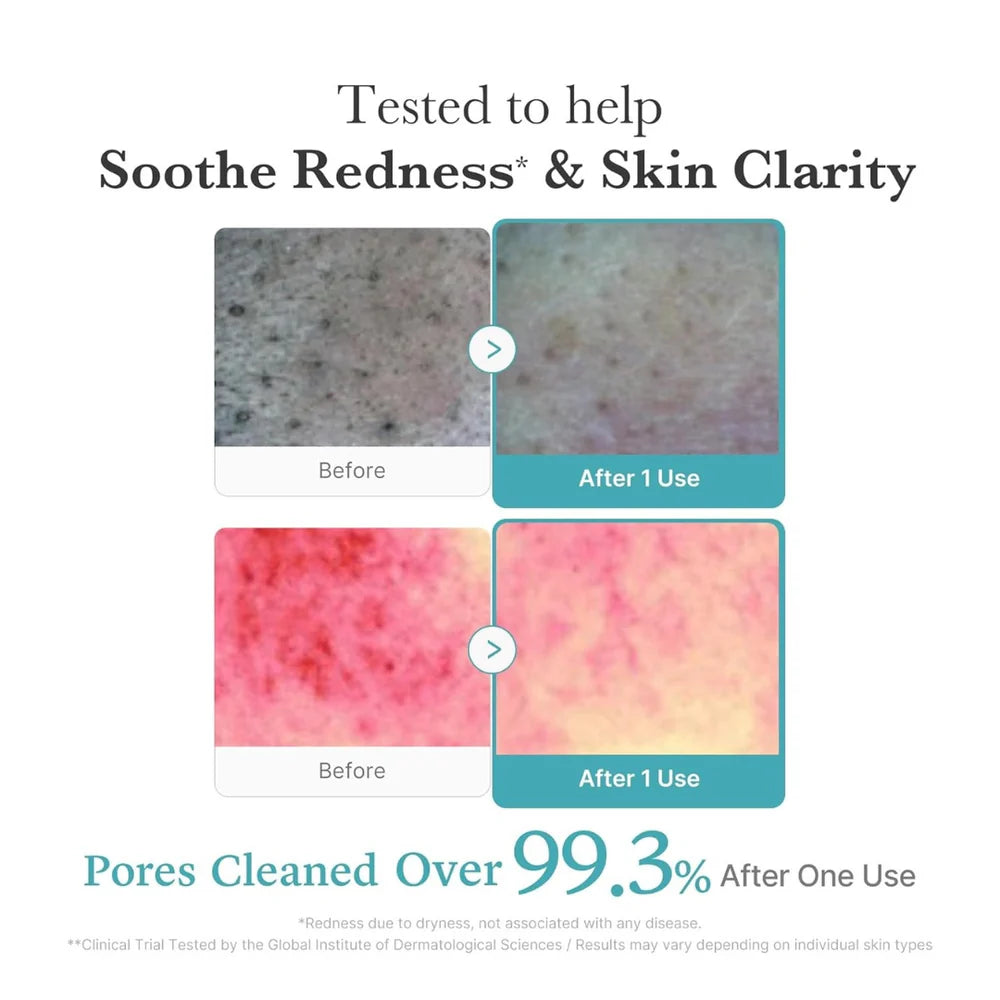 MEDICUBE - Azelaic Acid Niacinamide Deep Clean Foam Cleanser
