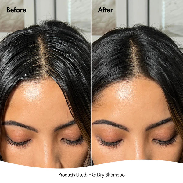 BondiBoost - HG Volumizing Dry Shampoo with Rosemary | 51 g