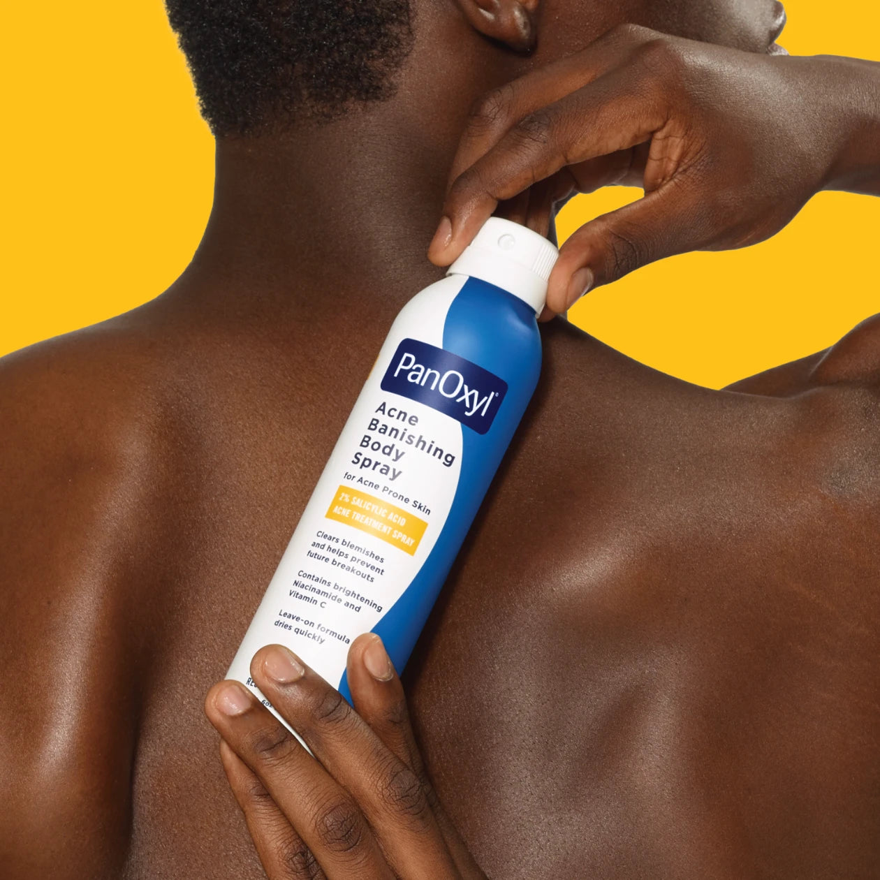 PanOxyl - Acne Banishing Body Spray with 2% Salicylic Acid | 170 g