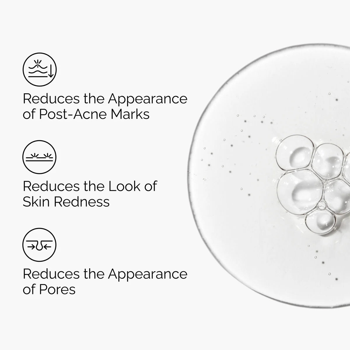 The Ordinary - Aloe 2% + NAG 2% Solution | 30 mL
