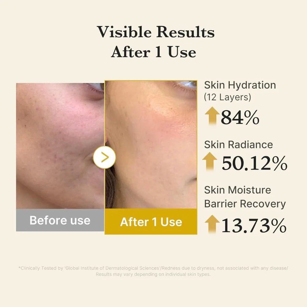 MEDICUBE - Kojic Acid Turmeric Vita Jelly Mist Serum