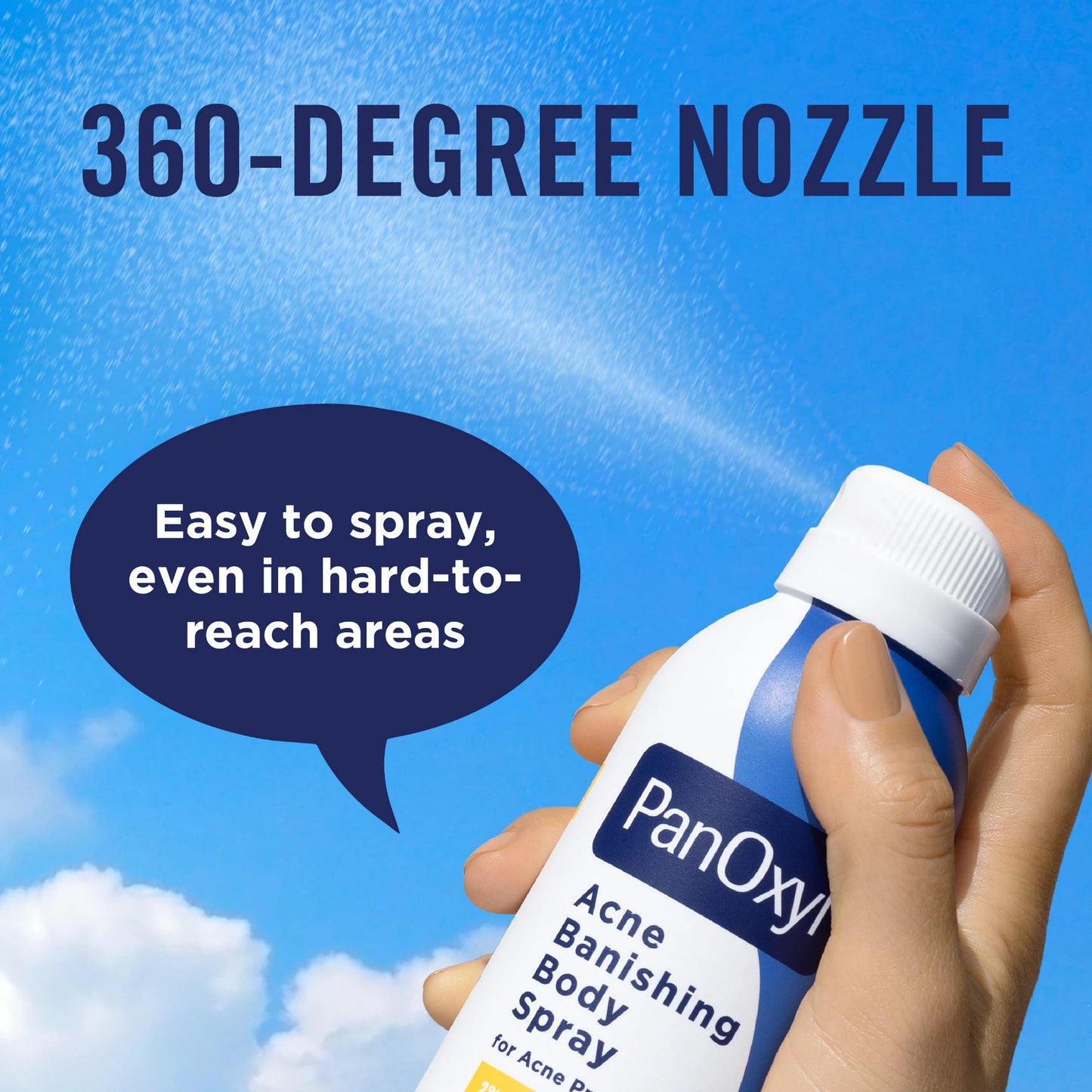 PanOxyl - Acne Banishing Body Spray with 2% Salicylic Acid | 170 g