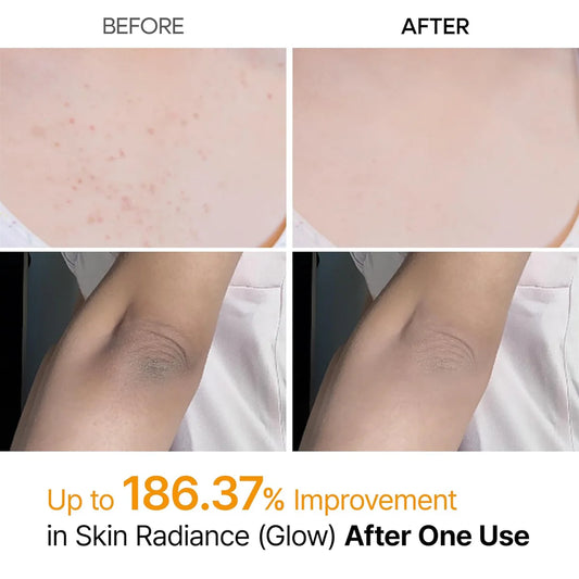 Dr.Melaxin - Peel Shot Exfoliating Kojic Acid Turmeric Spray | 200 ML