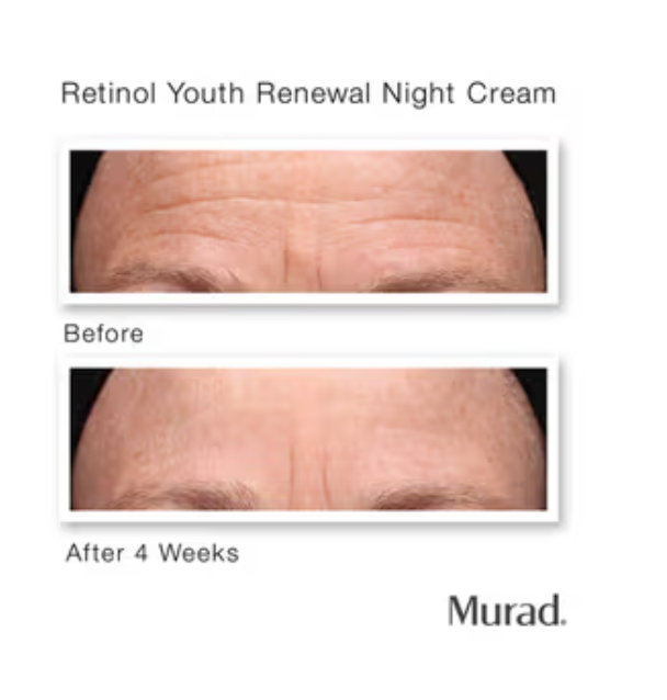 Murad - Retinol Youth Renewal Night Cream Mini Travel Size