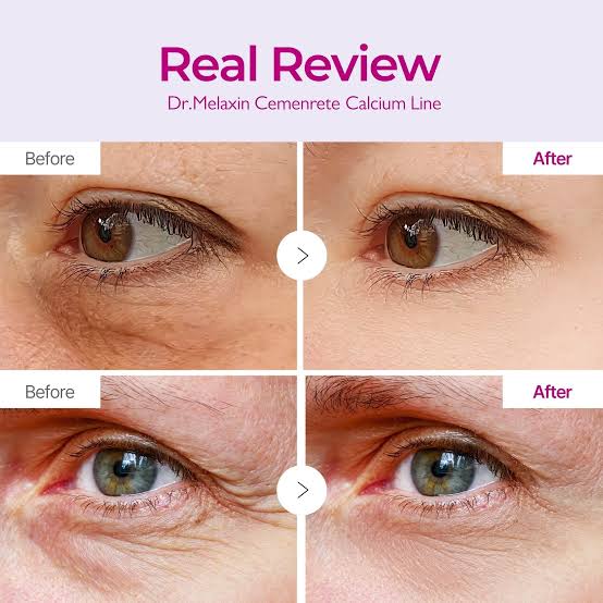 Dr. Melaxin - Calcium Volume Eye Patch