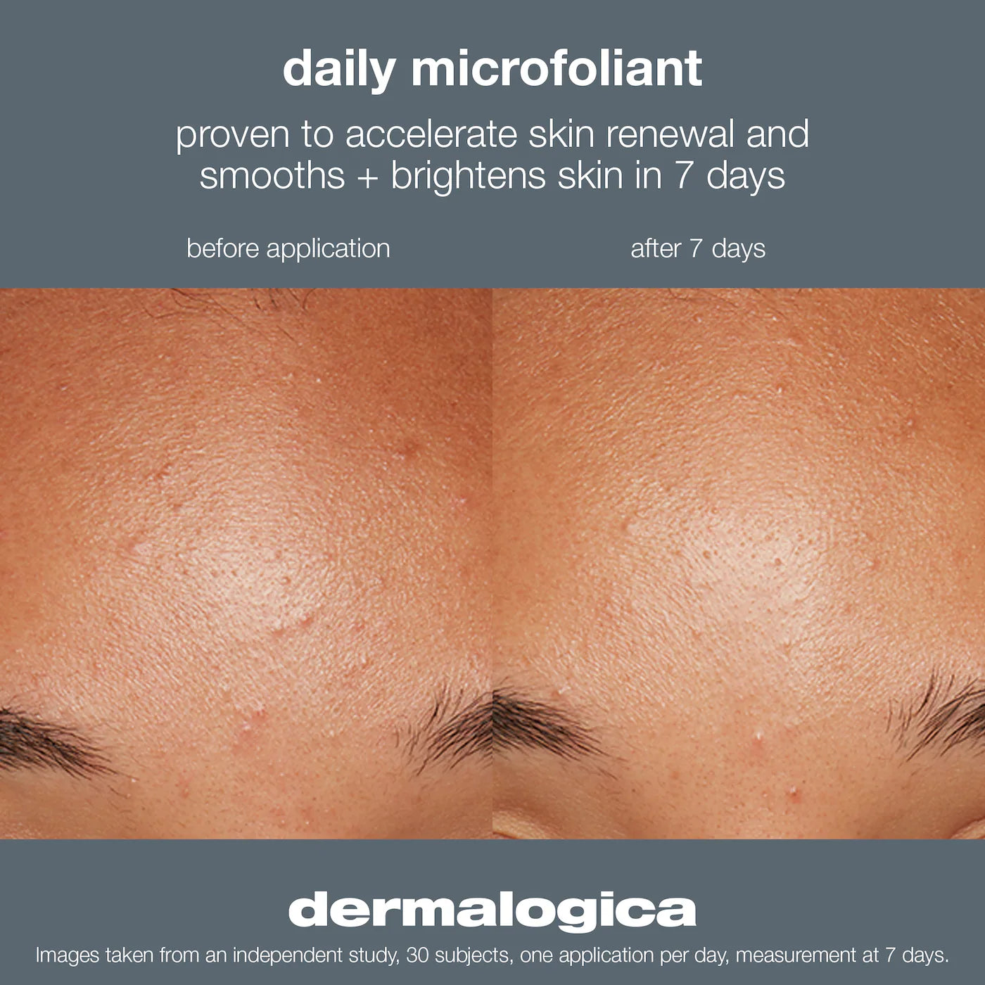 Dermalogica - Daily Microfoliant Refillable Exfoliator | 74 g