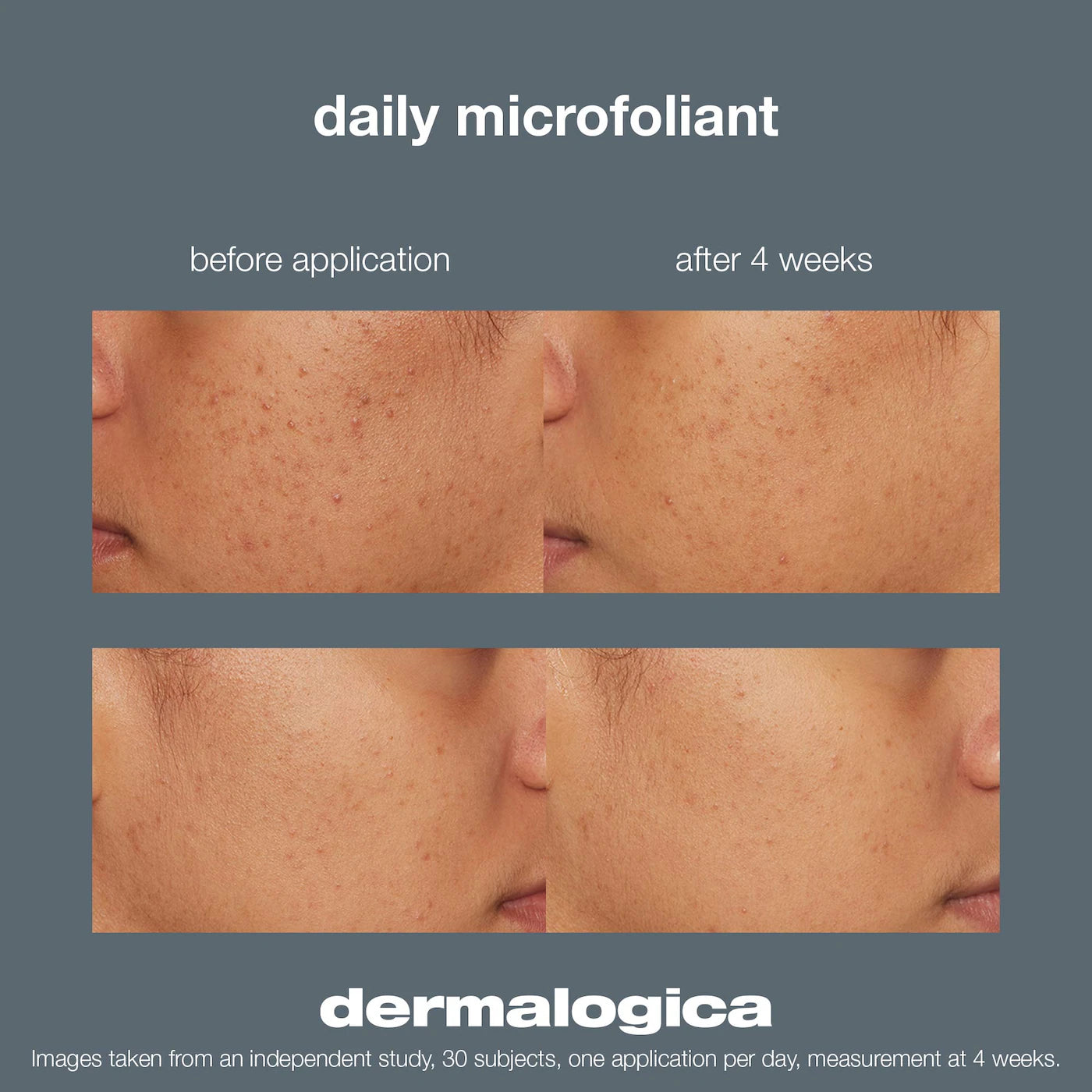 Dermalogica - Daily Microfoliant Refillable Exfoliator | 74 g