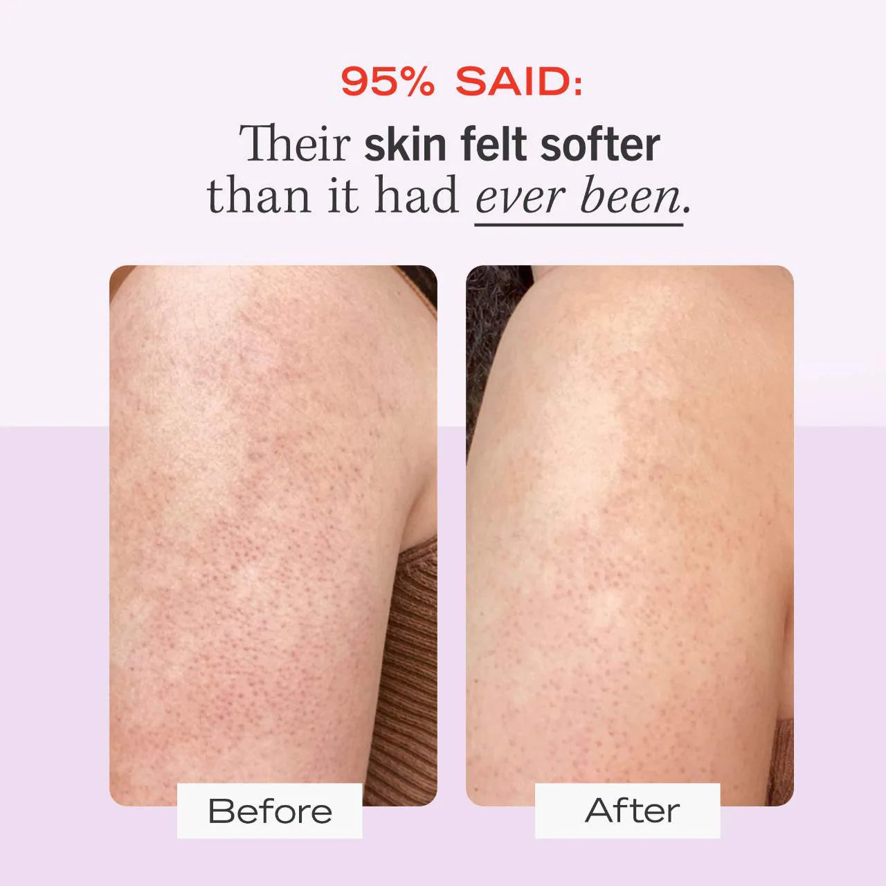 First Aid Beauty - KP BUMP ERASER BODY SCRUB 10% AHA | 226 g | Strawberry