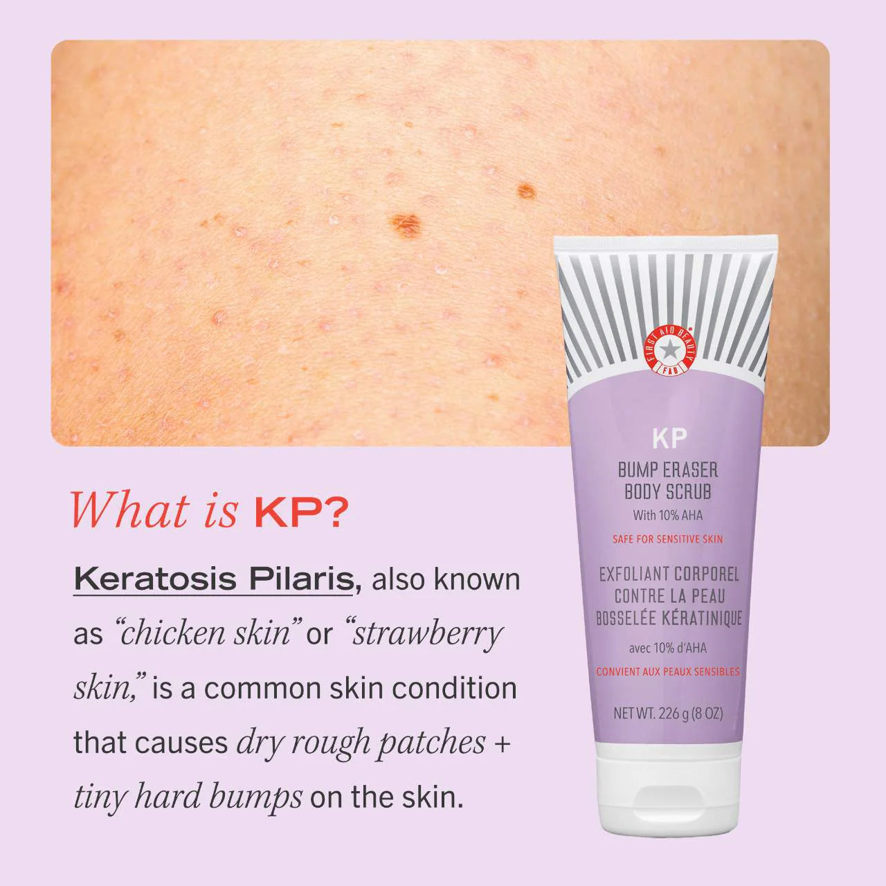 First Aid Beauty - KP BUMP ERASER BODY SCRUB 10% AHA | 226 g | Strawberry