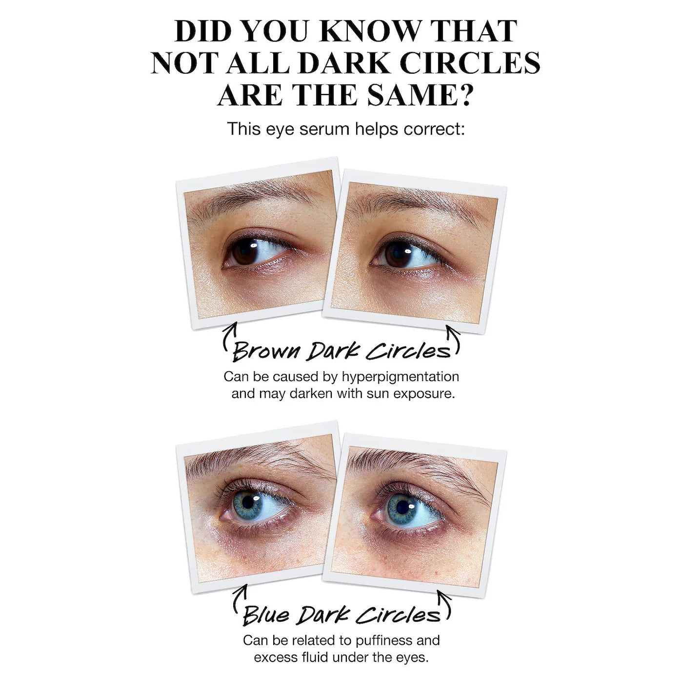 Kiehl's - Powerful-Strength Dark Circle Reducing Vitamin C Eye Serum | 15 mL