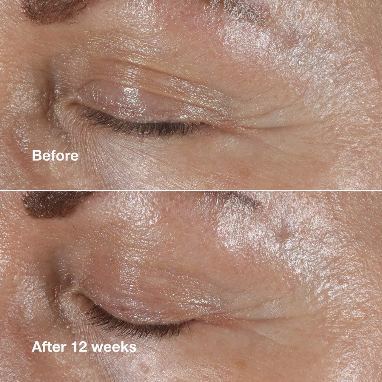 Clinique - Smart Clinical Repair™ Wrinkle Correcting Eye Cream | 15 mL
