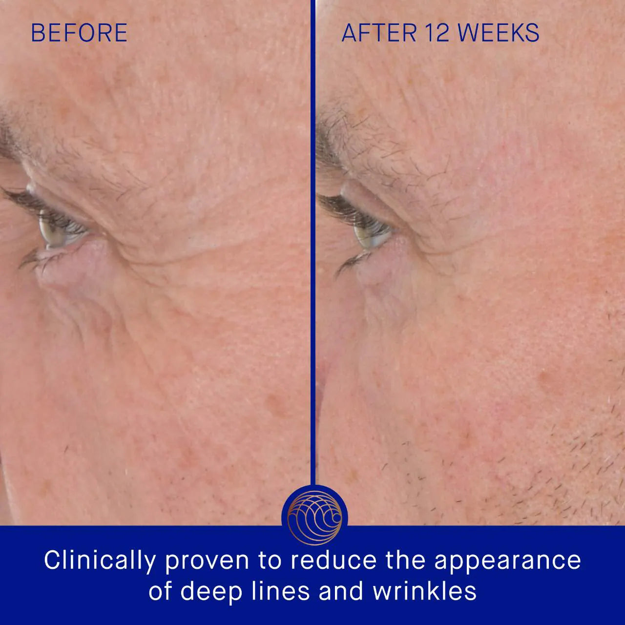 Augustinus Bader - The Retinol Serum with TFC8®