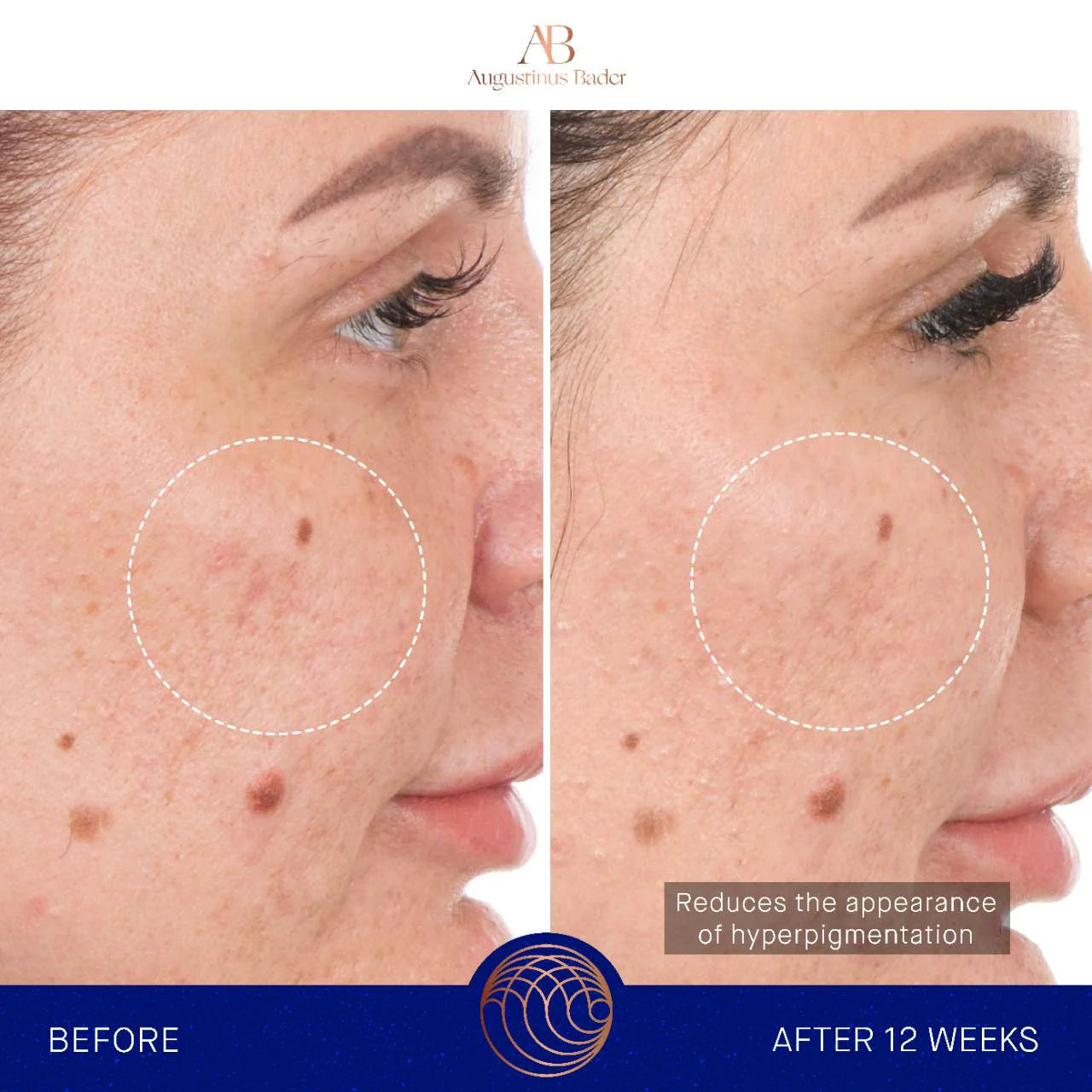 Augustinus Bader - The Retinol Serum with TFC8®