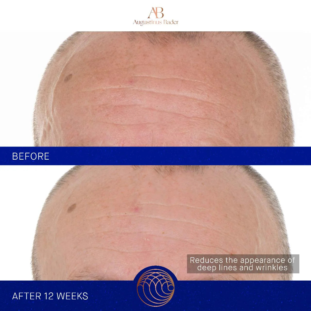 Augustinus Bader - The Retinol Serum with TFC8®
