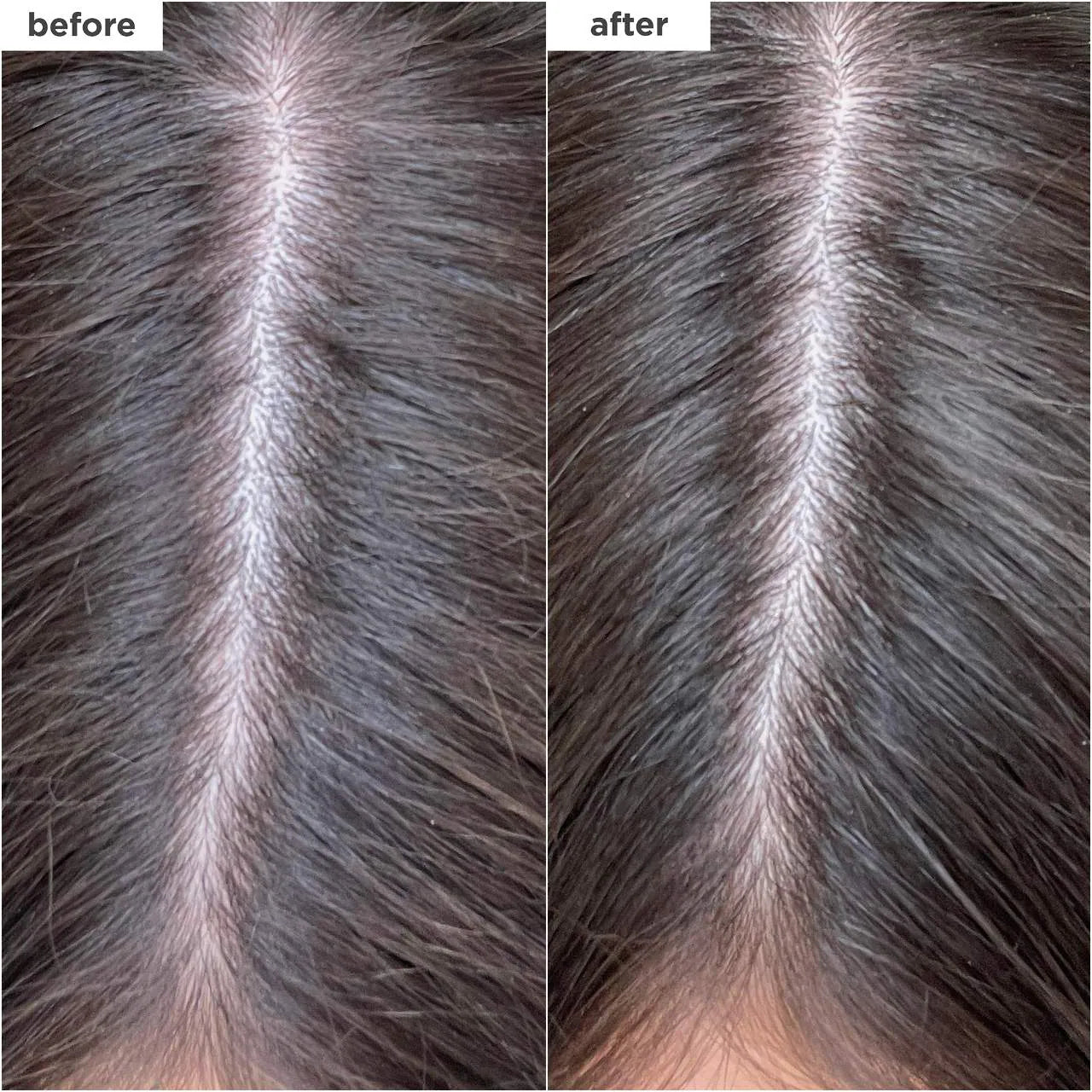 Briogeo - Scalp Revival Charcoal + Biotin Dry Shampoo | 50 mL