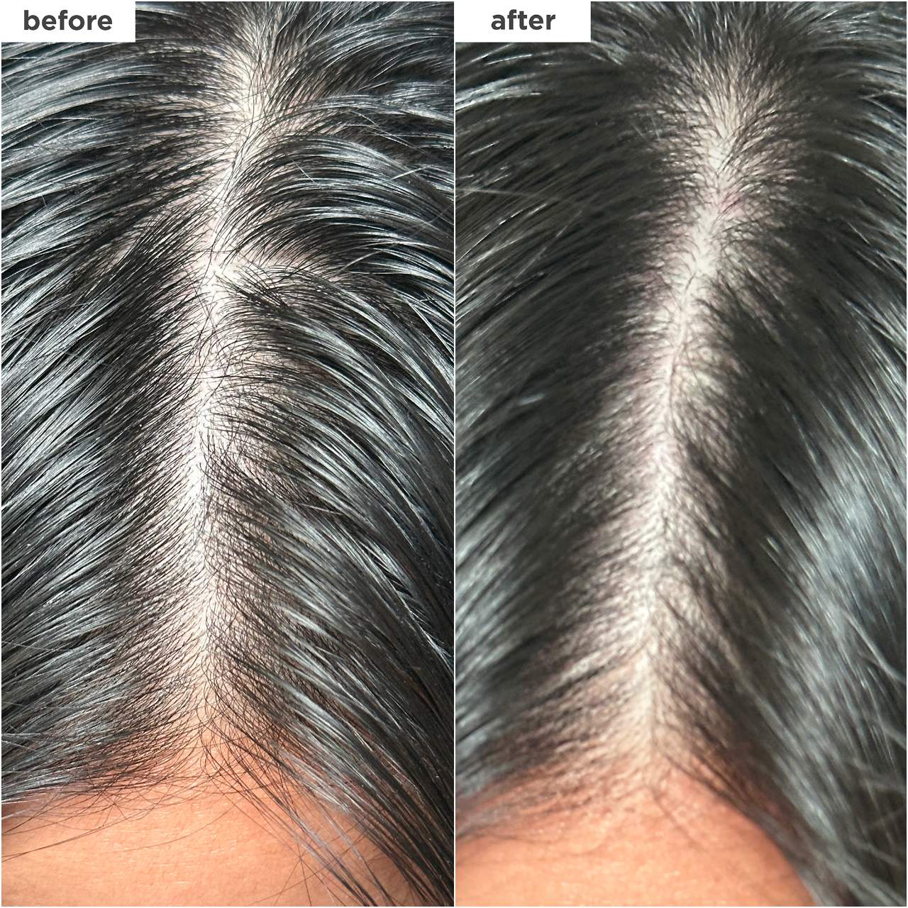 Briogeo - Scalp Revival Charcoal + Biotin Dry Shampoo | 50 mL